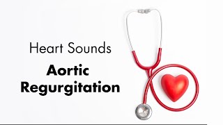 Aortic Regurgitation  Heart Sounds  MEDZCOOL [upl. by Paten]