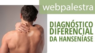 Webpalestra  Diagnóstico Diferencial da Hanseníase [upl. by Megan]