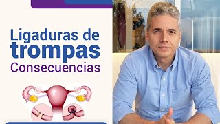 Consecuencias de la ligadura de trompas l Dr Juan Luis Giraldo [upl. by Ebert703]