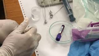 Bone marrow biopsy procedure [upl. by Ettenay]