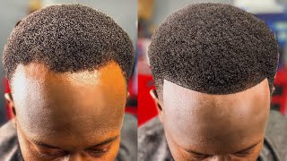 HOW TO FIX A BALDING RECEDING HAIRLINE  PERFECT HAIRCUT FIX [upl. by Gredel684]